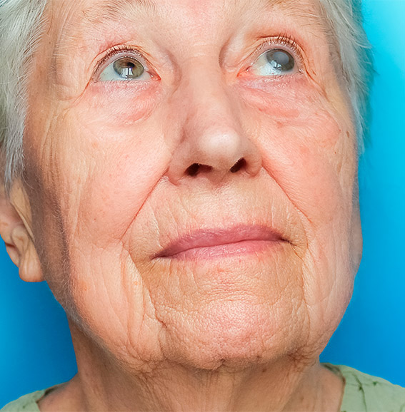 agende-uma-consulta-catarata