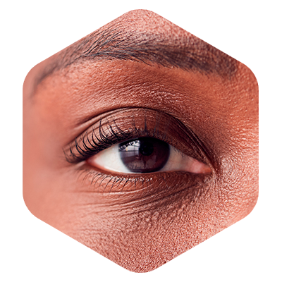 olho-cirurgia-de-retina-e-vitreo