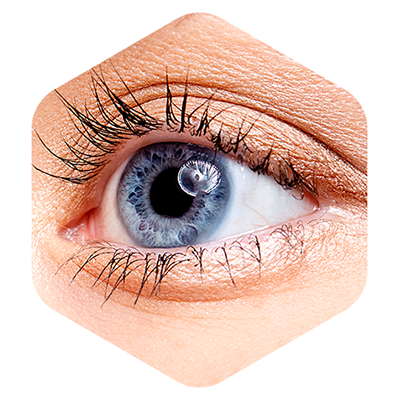 olho-doenca-ocular-catarata